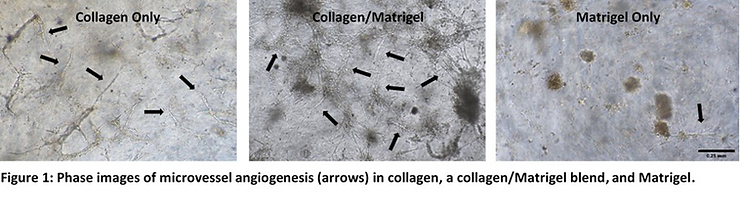 ��ԭ����/���ʽ��������΢Ѫ�����ɵĽ׶�